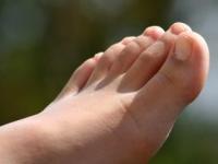 Tratament naturist pentru a scapa de bataturi